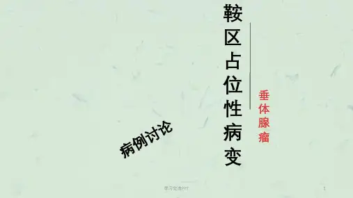 鞍区占位性病变ppt课件