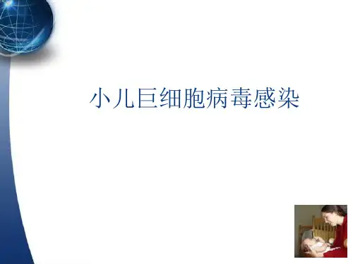 小儿巨细胞病毒感染的诊治