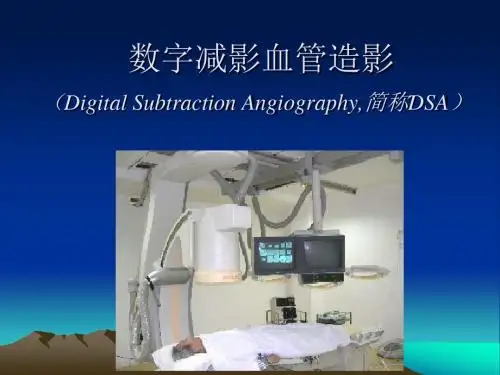 数字减影血管造影(DSA)