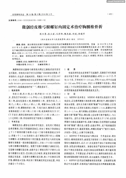 微创经皮椎弓根螺钉内固定术治疗胸腰椎骨折