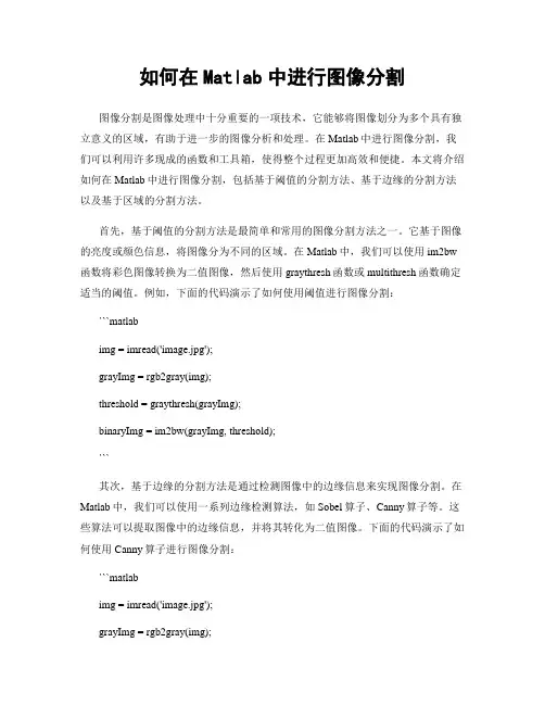 如何在Matlab中进行图像分割