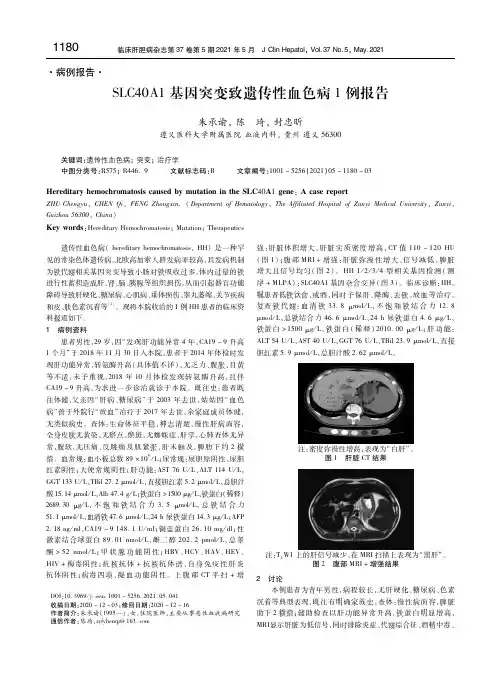 SLC40A1基因突变致遗传性血色病1例报告