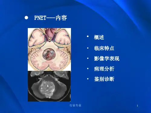 原始神经外胚层肿瘤行业专业