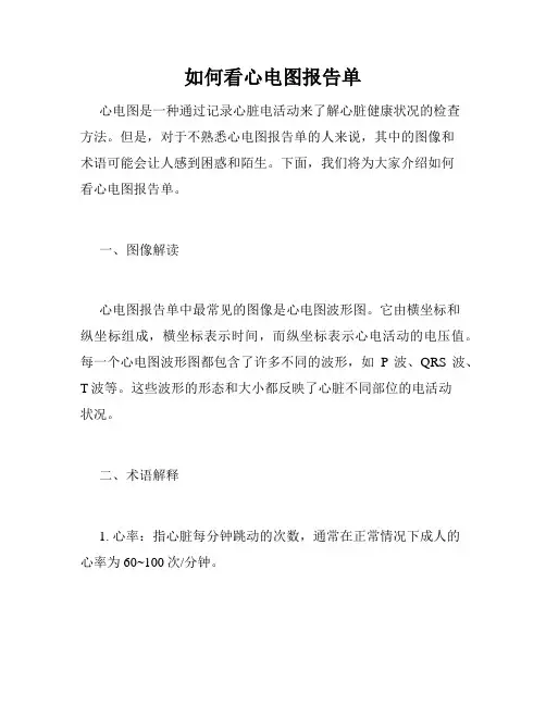 如何看心电图报告单