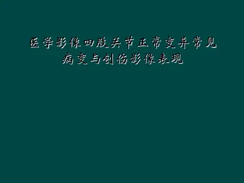 医学影像四肢关节正常变异常见病变与创伤影像表现