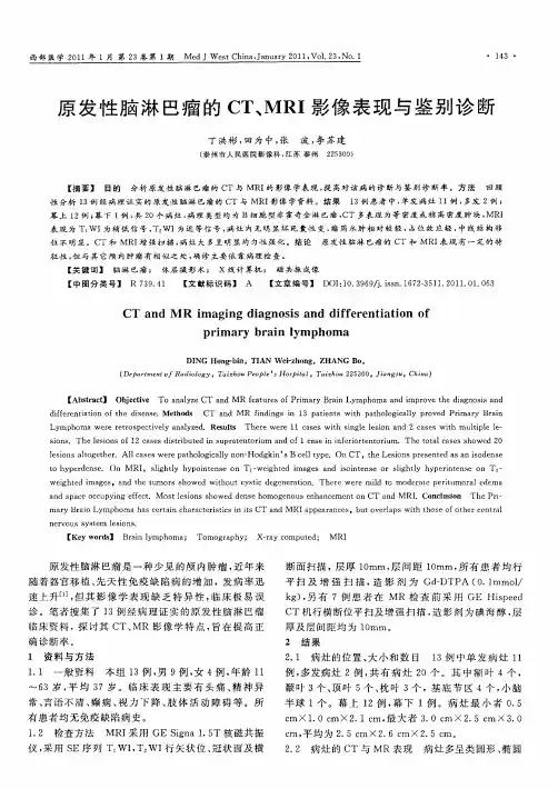 原发性脑淋巴瘤的CT、MRI影像表现与鉴别诊断