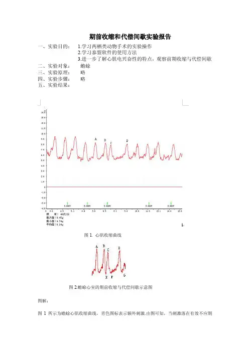 期前收缩与代偿间歇实验报告