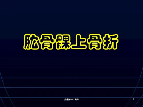 肱骨髁上、外髁、内上髁骨折ppt课件