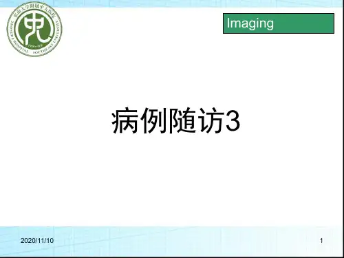 神经纤维瘤病54691 ppt课件