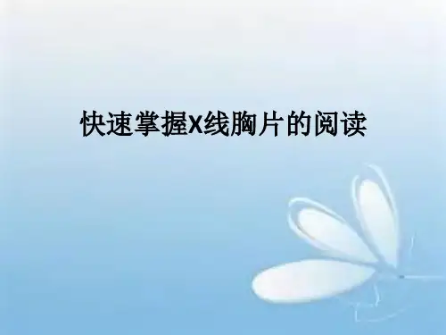 快速掌握X线胸片阅读