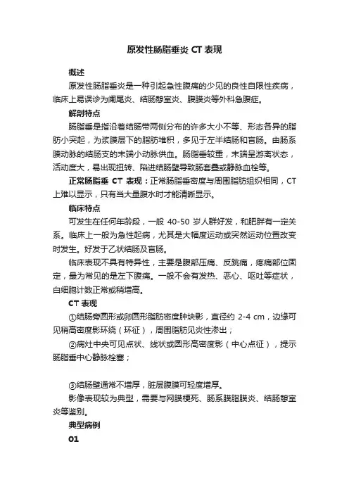 ?原发性肠脂垂炎CT表现