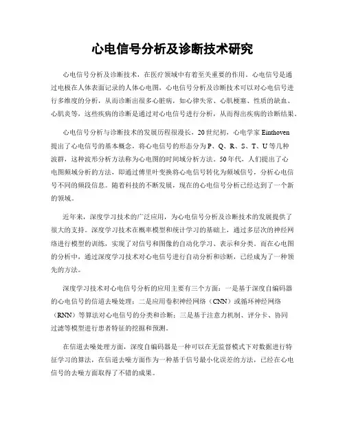 心电信号分析及诊断技术研究