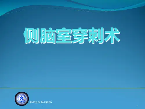 侧脑室穿刺术