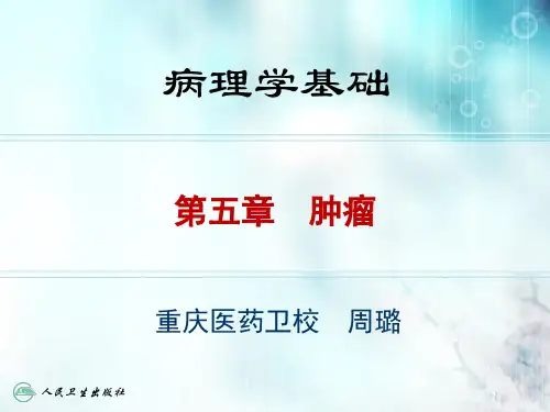 5-肿瘤