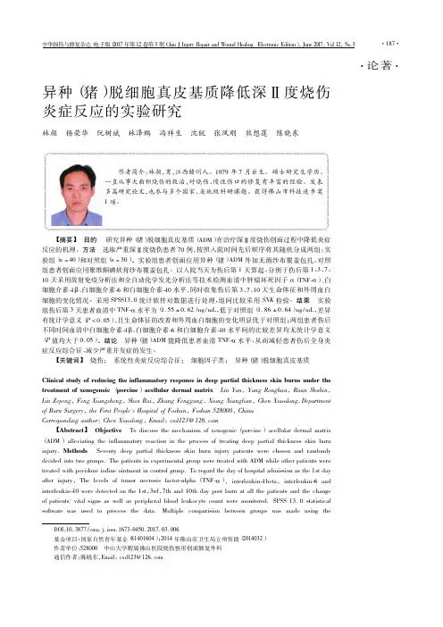 异种(猪)脱细胞真皮基质降低深Ⅱ度烧伤炎症反应的实验研究