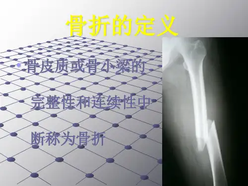 《骨科骨折》PPT课件