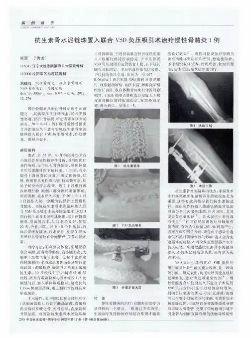 抗生素骨水泥链珠置入联合VSD负压吸引术治疗慢性骨髓炎1例