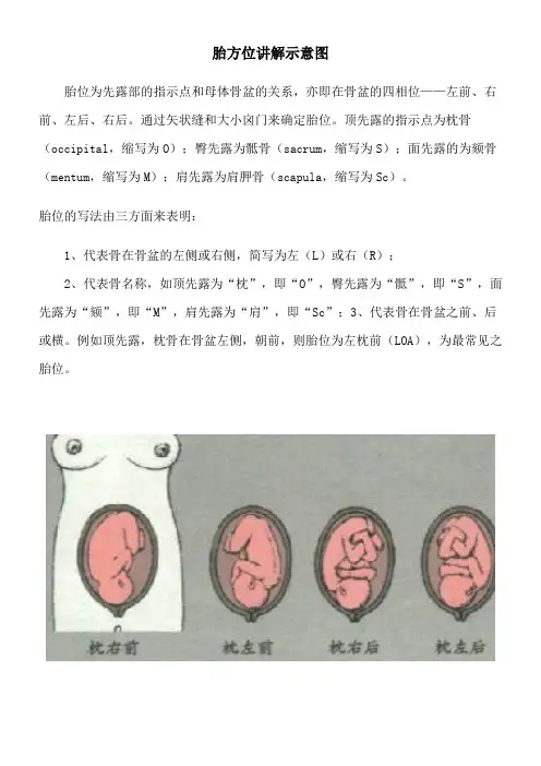 胎方位讲解示意图