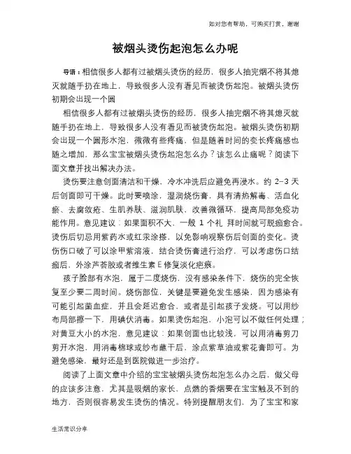 被烟头烫伤起泡怎么办呢