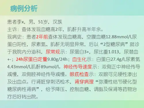 糖尿病肾病病例理论
