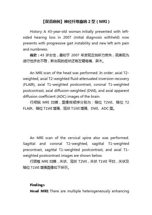 【双语病例】神经纤维瘤病2型（MRI）