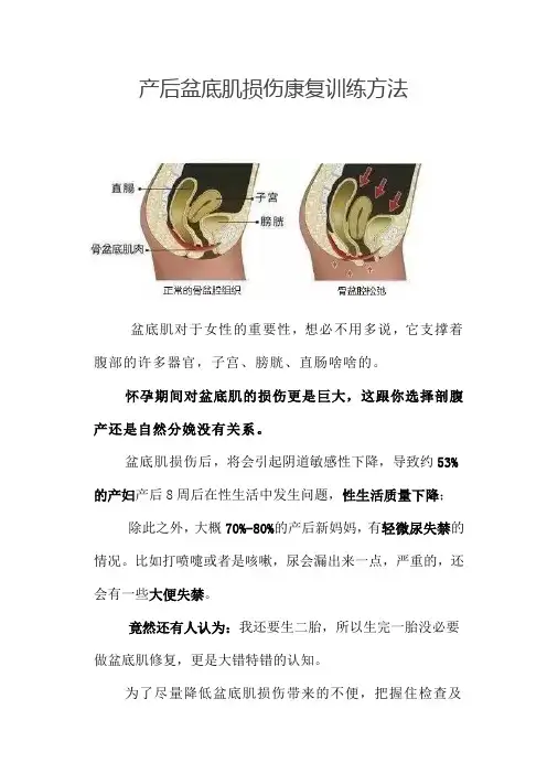 产后盆底肌损伤康复训练方法