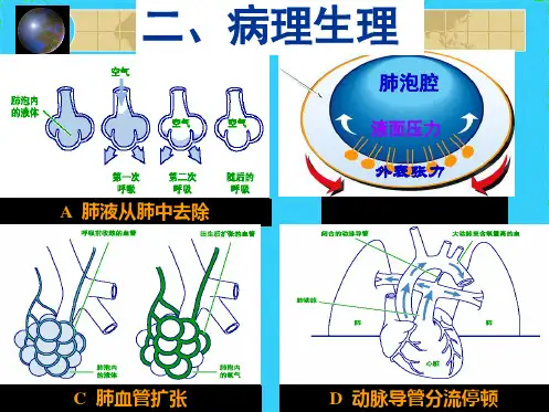 新生儿及新生儿疾病ppt课件(共9张PPT)