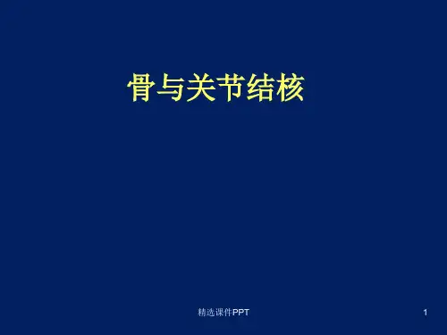 骨关节结核PPT课件