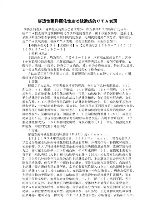 穿透性粥样硬化性主动脉溃疡的CTA表现