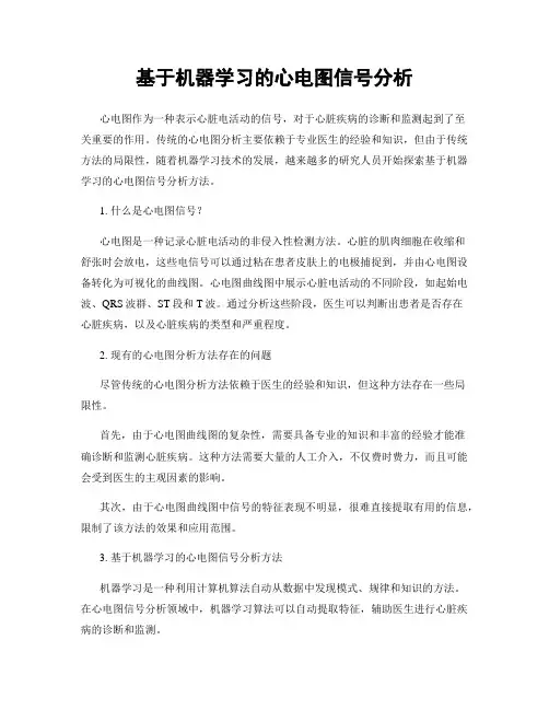 基于机器学习的心电图信号分析