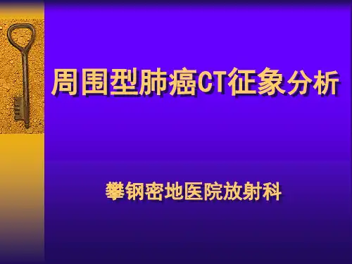 周围型肺癌CT征象分析报告