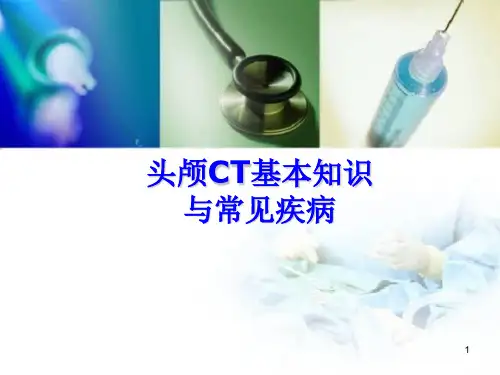 (优质课件)头颅CT基本知识与常见疾病