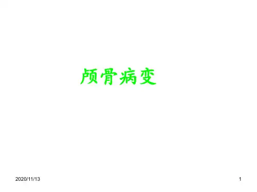 颅骨肿瘤及肿瘤样病变 ppt课件