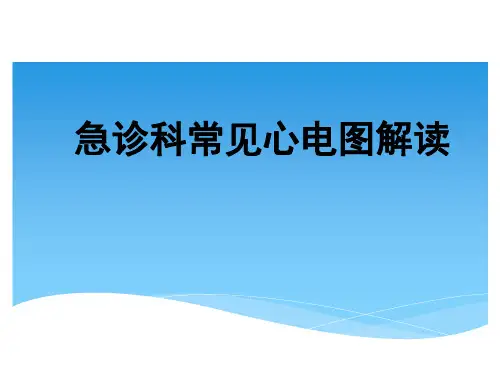 急诊科常见心电图解读