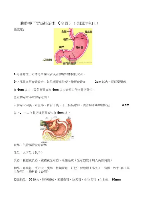 腔镜下全胃切除术手术步骤word精品