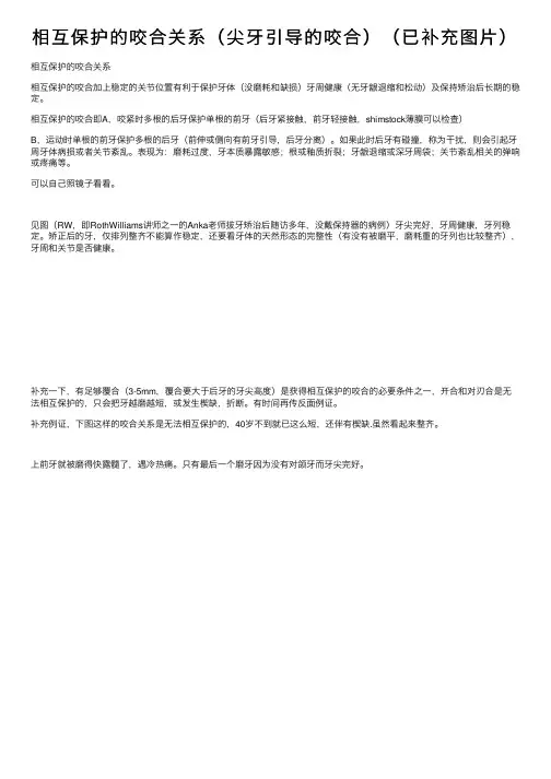 相互保护的咬合关系（尖牙引导的咬合）（已补充图片）
