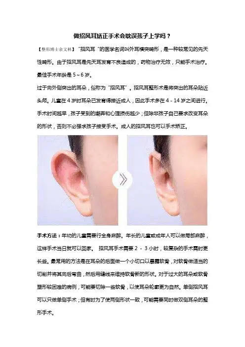 招风耳整形最佳年龄