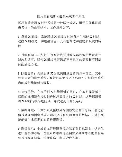 医用血管造影x射线系统工作原理