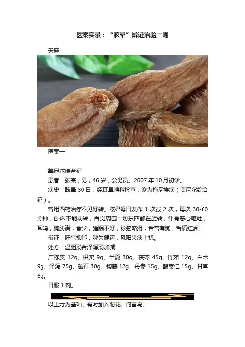医案实录：“眩晕”辨证治验二则