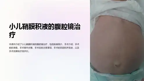 小儿鞘膜积液的腹腔镜治疗ppt课件