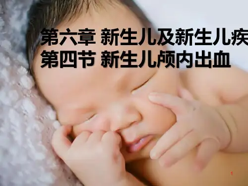 新生儿颅内出血PPT课件