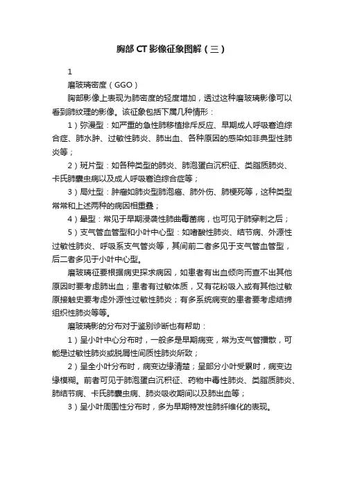胸部CT影像征象图解（三）