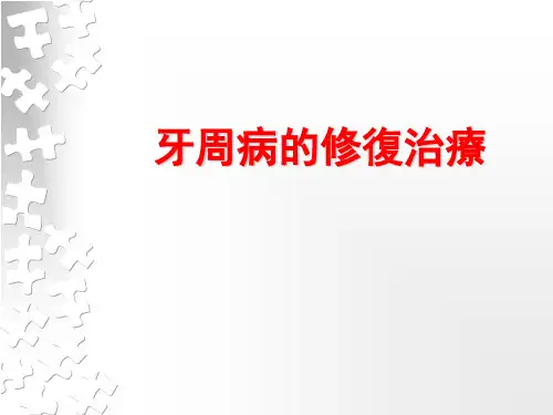 口腔修复学课件：牙周病的修复治疗