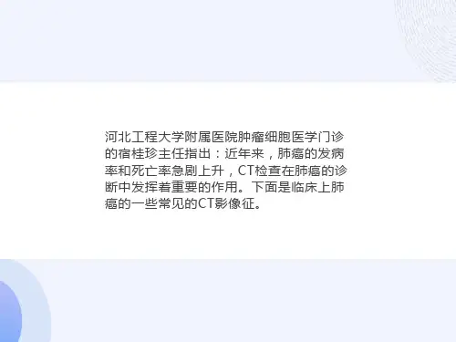 肺癌常见的七大CT影像特征