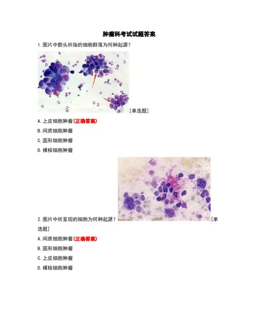 肿瘤科考试试题答案