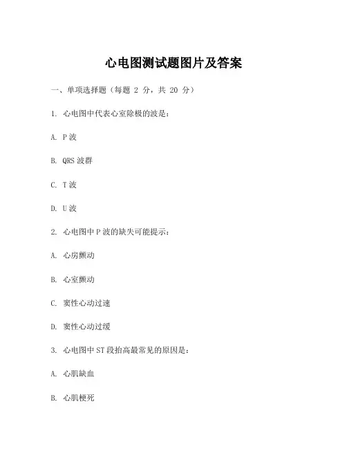 心电图测试题图片及答案