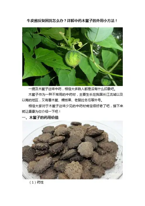 牛皮癣反复困扰怎么办？详解中药木鳖子的外用小方法！