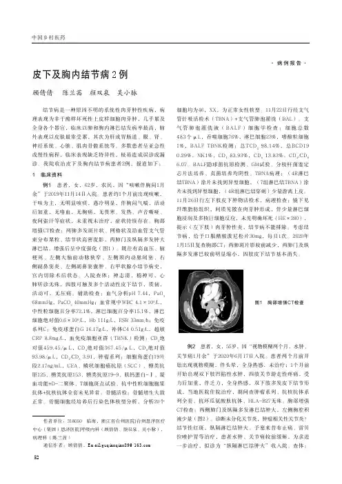皮下及胸内结节病2例