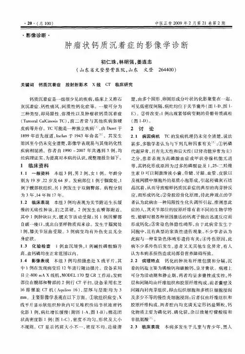肿瘤状钙质沉着症的影像学诊断