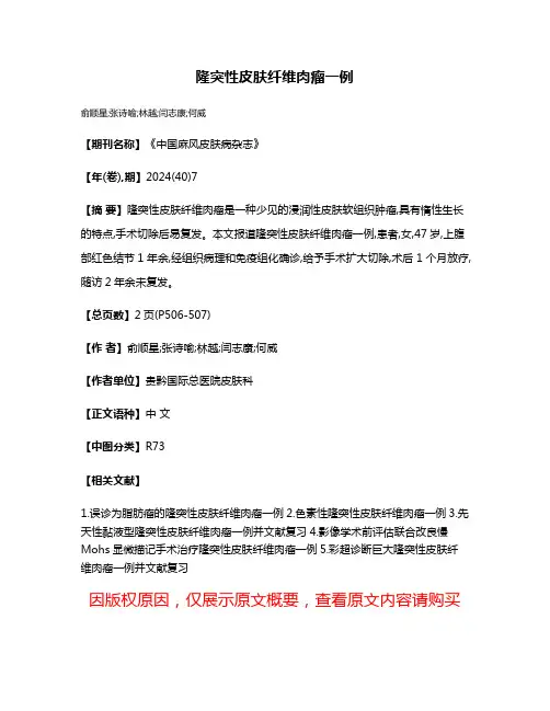 隆突性皮肤纤维肉瘤一例